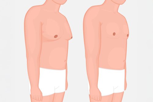 Subtle cosmetic enhancements for men with natural, refreshed results in Westchester County