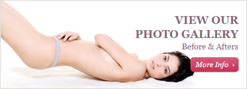 Plastic Surgery Photo Gallery